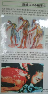 �u�Ԃ��w���v�J�����݂Ă鎁16�΁B���蔚�S�n�߂��ŏd�x�̉Ώ��B1�N9�J���������Q�̂܂܎��������܂�����B